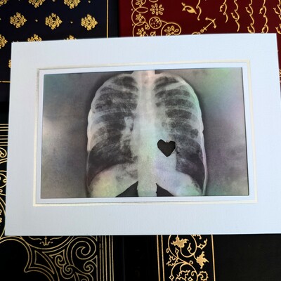 X-ray heart art print