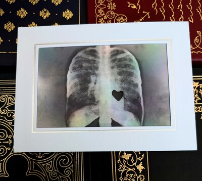X-Ray Heart Art Print