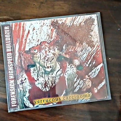 Viscera infest - verruccuous carcinoma 